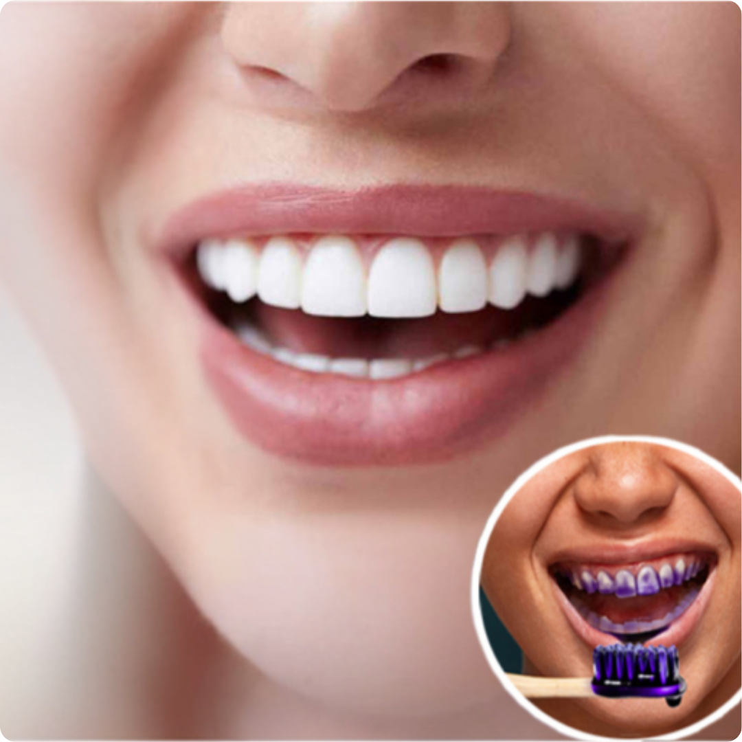 Blanqueador Dental Morada V34