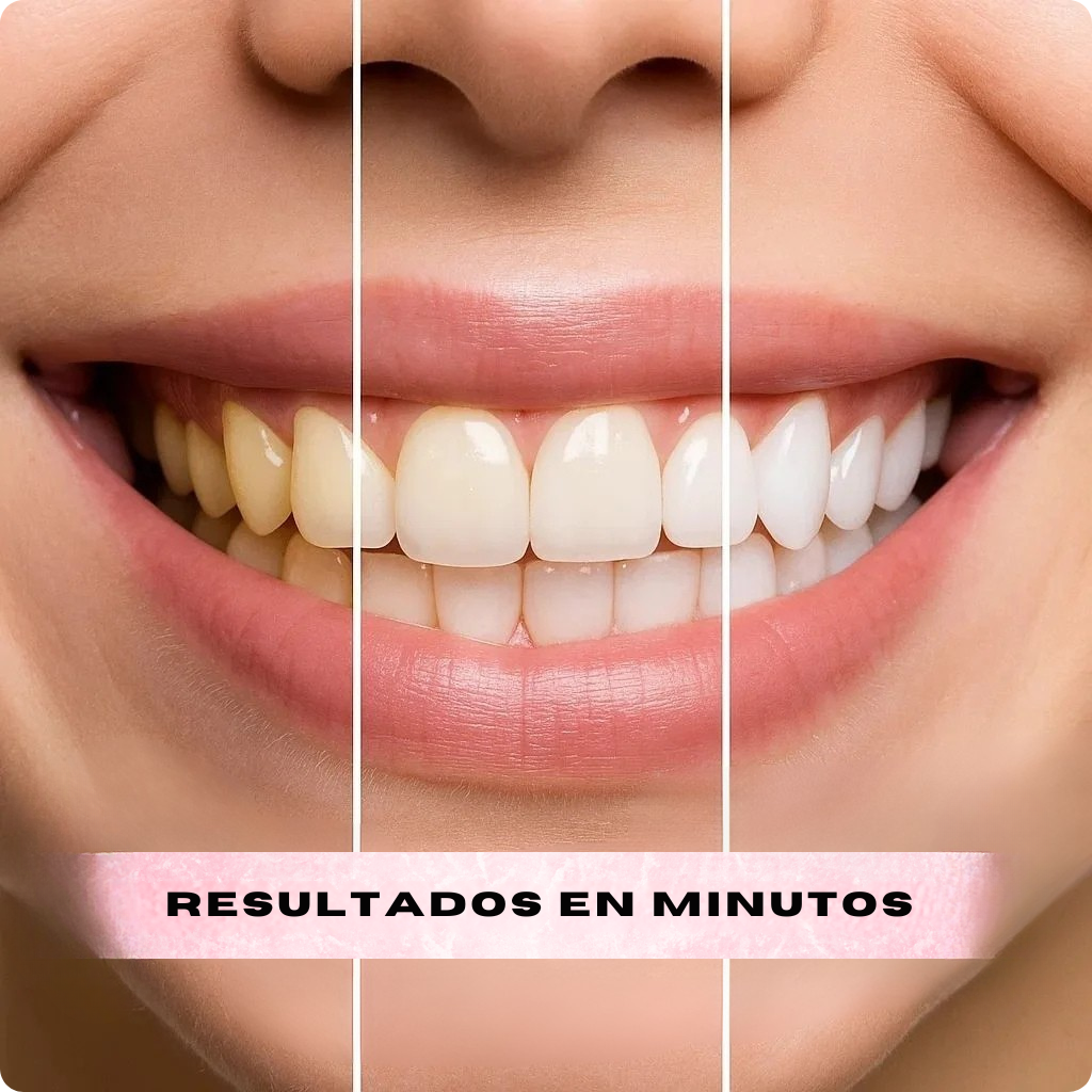 Blanqueador Dental Morada V34